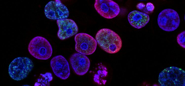 March 15 – Daily Message – Matthew 4:23 March 15 – Daily Message – Matthew 4:23